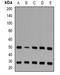 AT-Rich Interaction Domain 3A antibody, orb377934, Biorbyt, Western Blot image 