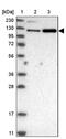 Ubiquitin Specific Peptidase 47 antibody, PA5-56103, Invitrogen Antibodies, Western Blot image 