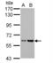 Asparagine Synthetase (Glutamine-Hydrolyzing) antibody, NBP2-14879, Novus Biologicals, Western Blot image 