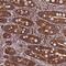 Nudix Hydrolase 15 antibody, NBP2-38436, Novus Biologicals, Immunohistochemistry paraffin image 