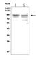 Toll Like Receptor 1 antibody, A00429-3, Boster Biological Technology, Western Blot image 