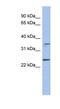 Necdin, MAGE Family Member antibody, NBP1-58244, Novus Biologicals, Western Blot image 