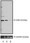 Cyclin Dependent Kinase 9 antibody, PA1-29427, Invitrogen Antibodies, Western Blot image 