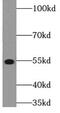 Serine/Threonine Kinase 38 Like antibody, FNab08338, FineTest, Western Blot image 