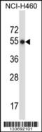 Neutrophil collagenase antibody, 57-223, ProSci, Western Blot image 