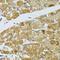 Autophagy Related 5 antibody, LS-C746969, Lifespan Biosciences, Immunohistochemistry paraffin image 