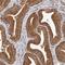 CDC42 Binding Protein Kinase Beta antibody, NBP1-81440, Novus Biologicals, Immunohistochemistry frozen image 