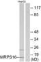 Mitochondrial Ribosomal Protein S16 antibody, PA5-38948, Invitrogen Antibodies, Western Blot image 