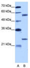 Copine 1 antibody, TA345867, Origene, Western Blot image 