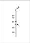 Sterile Alpha Motif Domain Containing 8 antibody, PA5-71622, Invitrogen Antibodies, Western Blot image 