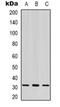 Carbonyl Reductase 3 antibody, orb319003, Biorbyt, Western Blot image 