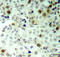 Cyclin Dependent Kinase 2 antibody, STJ22062, St John