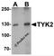 Tyrosine Kinase 2 antibody, 7177, ProSci, Western Blot image 