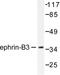 Ephrin-B3 antibody, LS-C176008, Lifespan Biosciences, Western Blot image 