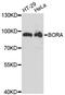 BORA Aurora Kinase A Activator antibody, LS-C748868, Lifespan Biosciences, Western Blot image 