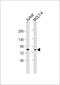 Lymphocyte Cytosolic Protein 2 antibody, 61-352, ProSci, Western Blot image 