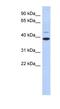 Ring Finger Protein 121 antibody, NBP1-59638, Novus Biologicals, Western Blot image 