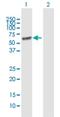 Leucine Rich Glioma Inactivated 1 antibody, H00009211-B01P, Novus Biologicals, Western Blot image 