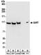 Phosphoribosylglycinamide Formyltransferase, Phosphoribosylglycinamide Synthetase, Phosphoribosylaminoimidazole Synthetase antibody, NBP2-32207, Novus Biologicals, Western Blot image 
