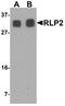 Rab Interacting Lysosomal Protein Like 1 antibody, A14157, Boster Biological Technology, Western Blot image 