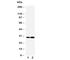 LIM and SH3 domain protein 1 antibody, R30889, NSJ Bioreagents, Western Blot image 