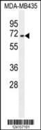 A-Kinase Anchoring Protein 17A antibody, 55-657, ProSci, Western Blot image 