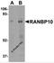 RAN Binding Protein 10 antibody, 5665, ProSci, Western Blot image 