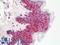 ETS Variant 6 antibody, LS-B10433, Lifespan Biosciences, Immunohistochemistry paraffin image 