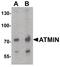 ATM Interactor antibody, PA5-38025, Invitrogen Antibodies, Western Blot image 