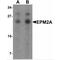 Laforin antibody, MBS150261, MyBioSource, Western Blot image 