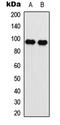 Eukaryotic Translation Elongation Factor 2 antibody, LS-C356006, Lifespan Biosciences, Western Blot image 