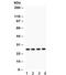 Fms Related Tyrosine Kinase 3 Ligand antibody, R32117, NSJ Bioreagents, Western Blot image 