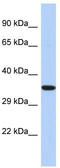 Epoxide Hydrolase 4 antibody, TA331396, Origene, Western Blot image 