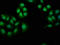 Nephrocystin 4 antibody, LS-C672534, Lifespan Biosciences, Immunofluorescence image 