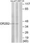 Olfactory Receptor Family 2 Subfamily B Member 2 antibody, A16517, Boster Biological Technology, Western Blot image 