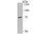 Solute Carrier Family 1 Member 1 antibody, A02367, Boster Biological Technology, Western Blot image 