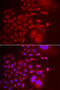 Trafficking Protein Particle Complex 10 antibody, abx005199, Abbexa, Western Blot image 