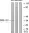 Olfactory Receptor Family 51 Subfamily G Member 2 antibody, TA315843, Origene, Western Blot image 