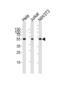 Peroxisome Proliferator Activated Receptor Alpha antibody, LS-C344153, Lifespan Biosciences, Western Blot image 