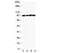 Minichromosome Maintenance Complex Component 4 antibody, R30736, NSJ Bioreagents, Western Blot image 