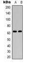 HNF1 Homeobox B antibody, orb339056, Biorbyt, Western Blot image 