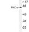 Protein Kinase C Alpha antibody, LS-C177756, Lifespan Biosciences, Western Blot image 