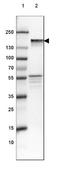 Neurofilament Medium antibody, NBP2-46616, Novus Biologicals, Western Blot image 