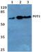Protection Of Telomeres 1 antibody, PA5-75366, Invitrogen Antibodies, Western Blot image 