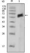 AXL Receptor Tyrosine Kinase antibody, NBP2-37675, Novus Biologicals, Western Blot image 