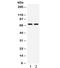 Eukaryotic Translation Initiation Factor 2 Alpha Kinase 2 antibody, R31995, NSJ Bioreagents, Western Blot image 