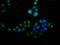 Vacuolar Protein Sorting 25 Homolog antibody, LS-C398088, Lifespan Biosciences, Immunofluorescence image 