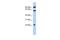 Tigger Transposable Element Derived 3 antibody, GTX46140, GeneTex, Western Blot image 