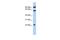 Tigger transposable element-derived protein 3 antibody, GTX46140, GeneTex, Western Blot image 