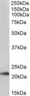 Transmembrane Protein 205 antibody, NBP1-52109, Novus Biologicals, Western Blot image 